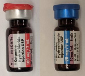 Two doses of IV Ketamine | Mind Brain Institute | Ketamine Assisted Therapy