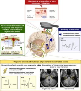 Multiple sites of peripheral co-stimulation during TMS | Transcranial Magnetic Stimulation | Mind Brain Institute