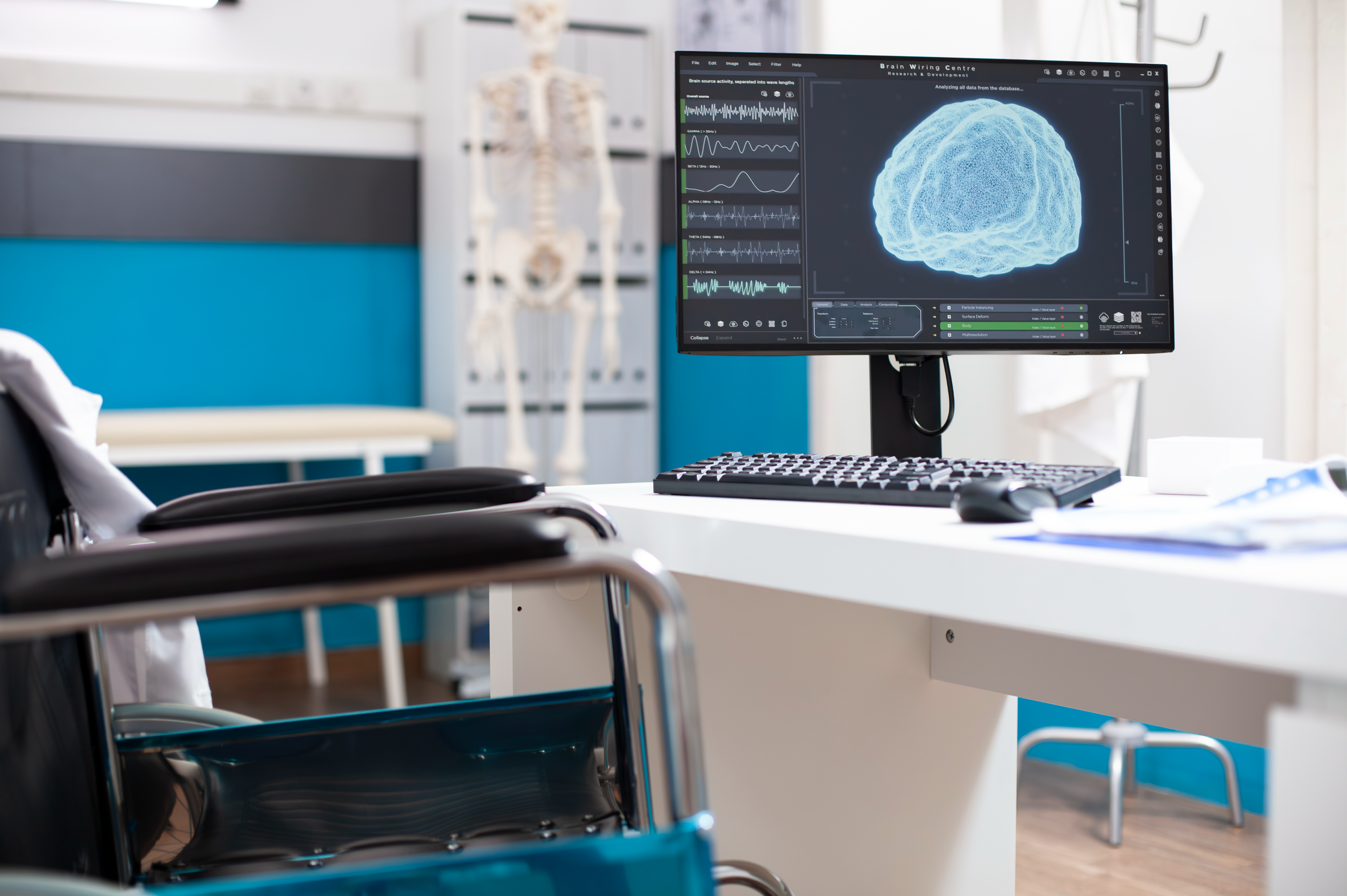Computer monitor displaying brain scan results in a mental health clinic, representing QEEG Brain Mapping and Neurofeedback Therapy for mental health treatment. | Mind Brain Institute