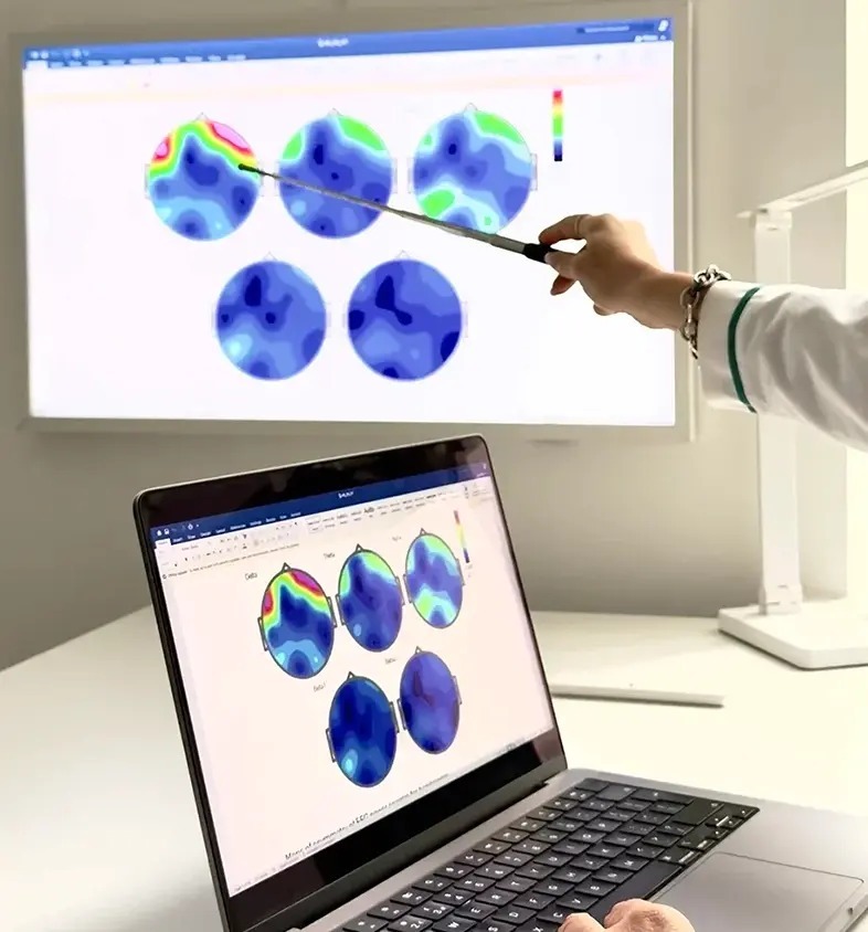 A brain mapping report is being shown in the image with a person's hand pointing out the reports with the help of their pointed markers