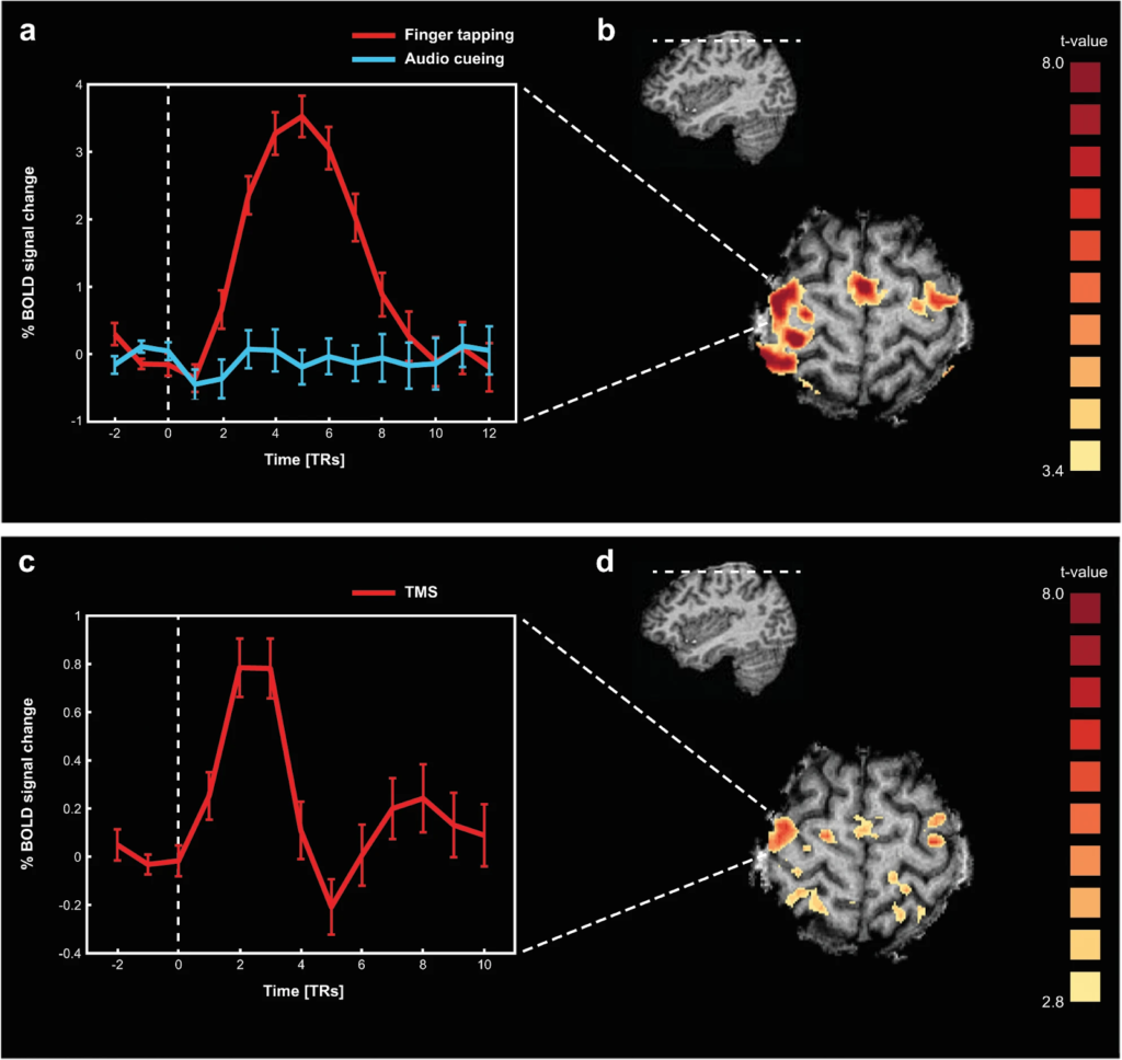 Illustrative representation of motor network localizer and TMS evoked responses