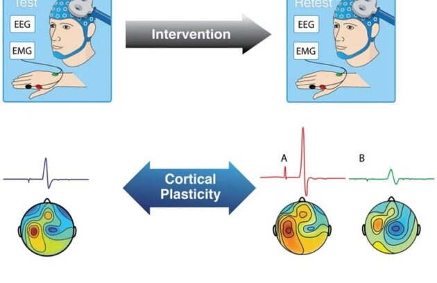 Illustrative representation of brain plasticity assessment with TMS