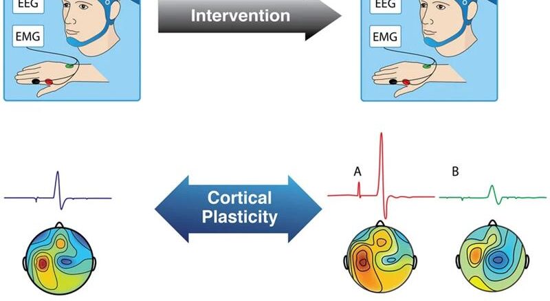 Illustrative representation of brain plasticity assessment with TMS
